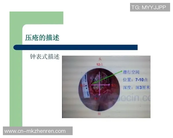 篮网与开拓者对决前夕伤病情况分析及影响评估